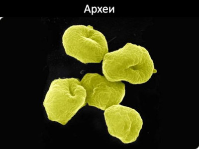 20 ценных аминокислот из углекислого газа: микробы археи прокормят человечество? - 10.jpg